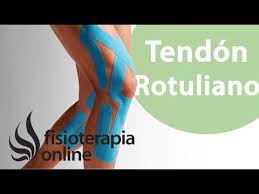 Kinesiostaping En La Tendinopatia Rotuliana Tendinitis Rotuliana Vendaje Neuromuscular Masaje Linfatico