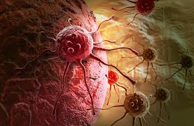 Any cancer can produce metastatic skin lesions but the cancers described below are the types more likely to spread to the skin. Everything You Need To Know About Skin Cancer Dermatologist In Honolulu Hi