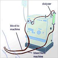 A Dialysis Machine Is A Form Technology Used For Patients Who Suffer From Kidney Failure As A Way Of Removing Unwan Dialysis Dialysis Machine Pediatric Nursing