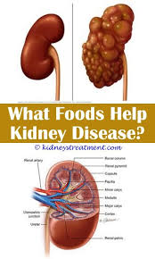 Pin On Kidney Disease