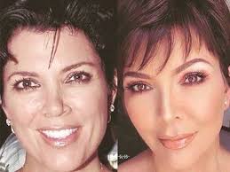 Rachel Jarrell ~ Houston Aesthetic Nurse Practitioner