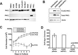 Symptoms will vary depending on where the cancer is. Atypical Protein Kinase Ci Plays A Critical Role In Human Lung Cancer Cell Growth And Tumorigenicity Journal Of Biological Chemistry