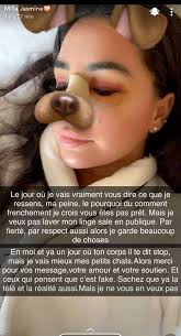 Milla jasmine a été placée en garde à vue quelques heures après une altercation avec un agent sncf survenue gare milla jasmine placée en garde à vue, elle s'explique sur la polémique. Milla Jasmine Celibataire Sa Rupture Avec Mujdat A L Origine De Sa Rhinoplastie