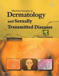 Neena Khanna Illustrated Synopsis Of Dermatology And Sexually Transmitted Diseases Free Pdf Dermatology Medical Textbooks Medicine Book