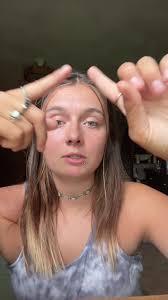 Jamie Winfield Update