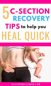 5 C Section Recovery Tips To Help You Heal Quick After A Cesarean Postpartum Recovery Tips For C Section Moms Product C Section Recovery Heal Quick C Section