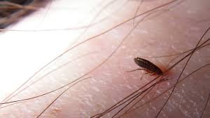 Some pets can be hypersensitive to the flea's saliva and will itch all over from the bite of even a single flea. Can Fleas Live And Reproduce On Human Blood Fleascience