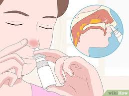 9 cara cepat mengatasi hidung tersumbat pada bayi. 3 Cara Untuk Meredakan Hidung Tersumbat Wikihow