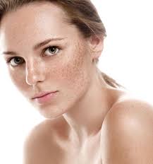 Chemical Peel Women