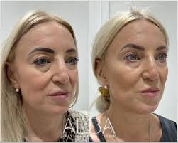 ALBA Skin & Beauty Clinic