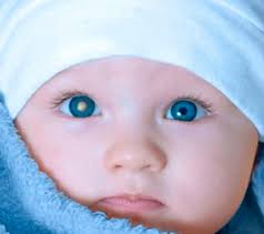 17 de agosto Día Internacional de la Enfermedad de Coats