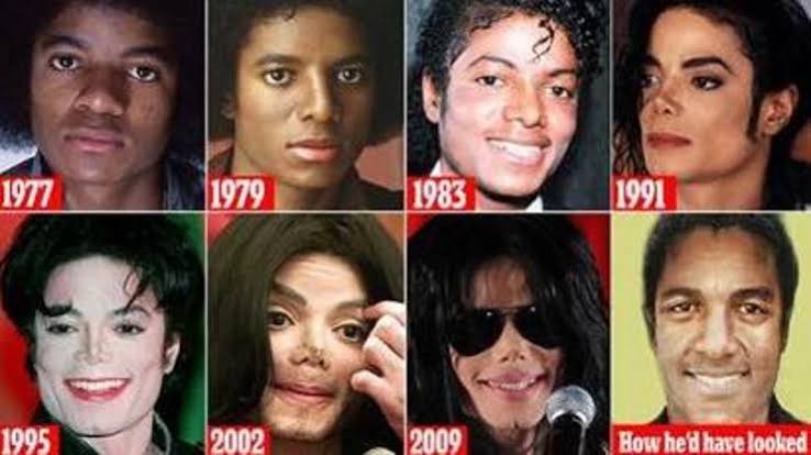 ماذا فعلت 100 جراحة تجميل في وجه مايكل جاكسون؟