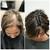 First Signs Of Hair Thinning