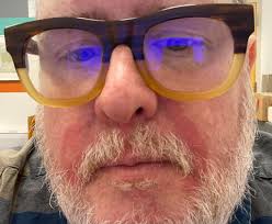 Help? My face seems to be getting worse. I soak in cold water every morning  and this redness will not go away. 😞 Apologies for the closeup. Resmed  AirSense F40 is my