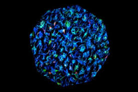 Image result for Pollia condensata