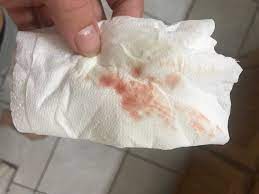 The loss of the mucus plug usually signals that labor is imminent, though it can be up to two weeks. Spotting At 8 Weeks Pic 1st Pregnancy Forums What To Expect