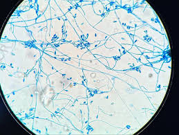 Image result for Microchloa altera