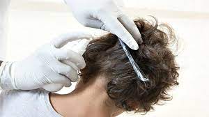 We did not find results for: 8 Penyebab Rambut Rontok Pada Anak Dan Cara Mengatasinya Hot Liputan6 Com