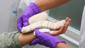 Infection is a rare complication of hand surgery. Carpal Tunnel Release Johns Hopkins Medicine