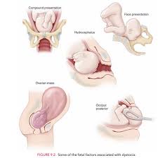 Image result for Compound Presentation