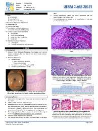 Maybe you would like to learn more about one of these? Pathology 5 05a Cervix Cervical Cancer Medical