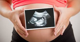 Image result for pcos and pregnancy