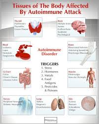 The Autoimmune Nutrition Plan To Reduce Inflammation Drjockers Com In 2020 Rheumatoid Arthritis Diet Polymyalgia Rheumatica Rheumatoid Arthritis