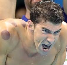 Michael phelps' advantages are his height, weight and the length of both his arms and legs. Michael Phelps Welt