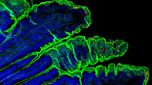 Cryptosporidium is selected as target for this risk assessment. Relieving The Bottleneck In Cryptosporidium Vaccine Development Technology Networks