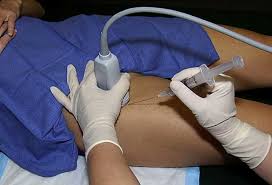 Image result for Hip Injection