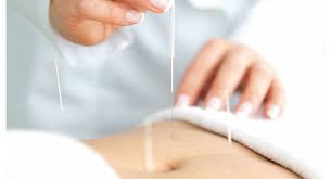 Herzlich willkommen auf den internetseiten der praxisklinik orthospine ansbach. Akupunktur Nadeln Gegen Beschwerden