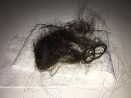 Hair Loss 4 Month After Birth Photo Netmums