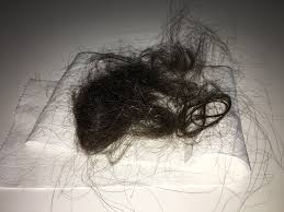 It's quite normal to lose some hair after having aa baby. Hair Loss 4 Month After Birth Photo Netmums