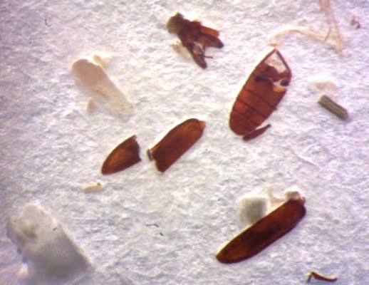 Analysis of Foreign Matter in Foodstuffs (Filth Test) - AGROLAB GROUP