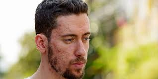 Massage the back acne scars area with this washcloth for few minutes by using a back scratcher or your fingers. Here S How To Get Rid Of Your Acne Scars Men S Health