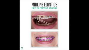 Philadelphia Orthodontist - Cosmetic Dentistry In Philadelphia Pennsylvania  | Roberts & De Marsche - Philadelphia Orthodontist