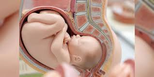 plasenta previa op dr tahir ozguder