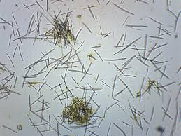 Mixed Spicules - Prepared Microscope ...