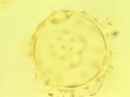 Image result for Dombeya shupangae