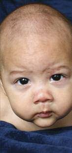 Bristol Safeguarding Children Board Annual Report