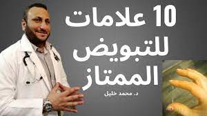 علامات و اعراض التبويض الممتاز و اعراض و علامات نزول البويضة و الاباضة في الدورة الشهرية Youtube