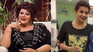 لن تتخيل كيف تغير شكل الفنانة الهام الفضالة بعد عملية تدبيس المعدة women fashion women s top