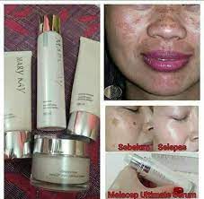 Jadi, aku suruh cari produk yang sesuai khas untuk jeragat. Hilangkan Memey Mary Kay Independent Beauty Consultant Facebook