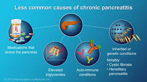 Pin On Pancreatitis