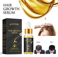 Biotin is a b vitamin that is essential. Jemros Extra Biotin Herbal Serum Fast Hair Growth Serum Essential Oil Hai Q 3 Ebay