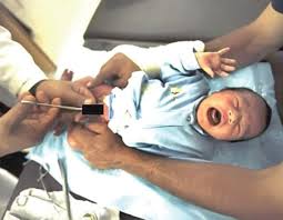 Then, you can resume bathing your newborn in a tub of warm water. Newborn Circumcision Caring For Your Child After The Procedure Tribune Online