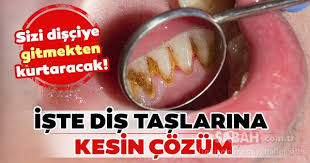 Dişteki siyah lekeler, dişteki siyah lekeler nasıl temizlenir, diş lekeleri, dişte siyah lekeler, dis kararmasi nasil gecer, diş lekeleri nasıl çıkar, diş siyah leke, diste. Dis Taslari Nasil Gecer Iste Dis Tasindan Kurtulmanin Yollari Galeri Saglik
