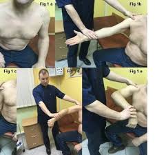 Image result for Yergason Test