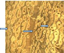 Image result for Isoberlinia doka