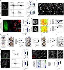 IRE1α governs cytoskeleton remodelling and cell migration through a direct interaction with filamin A.